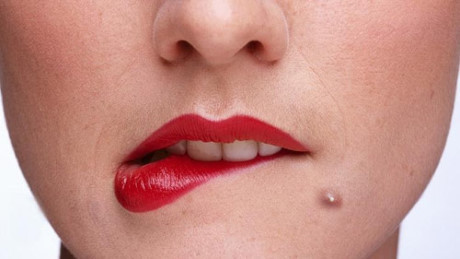 7 liệu pháp trị mụn bọc dễ làm tại nhà - Ảnh 1 7 lieu phap tri mun boc de lam tai nha - Anh 1