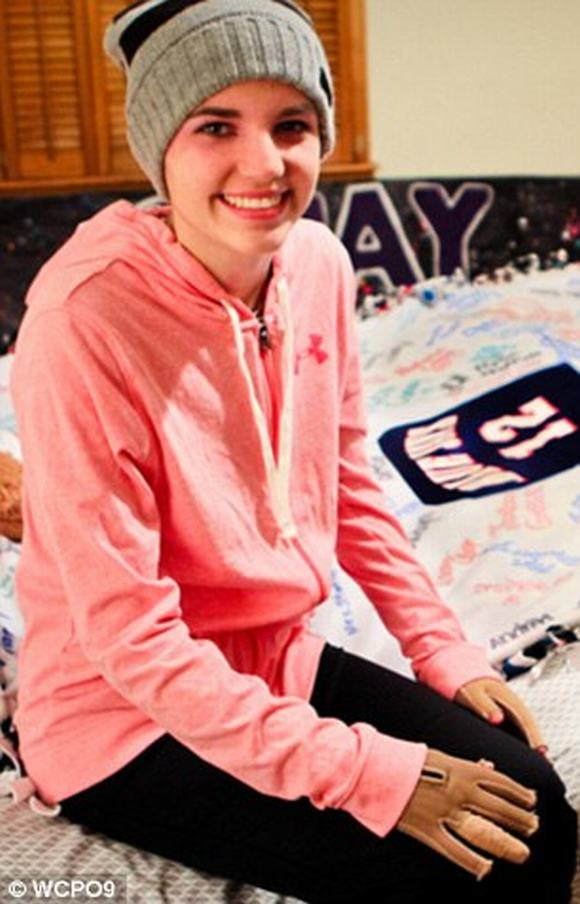 Cô gái 16 tuổi hồi phục nhanh kỳ diệu sau vụ cháy kinh hoàng