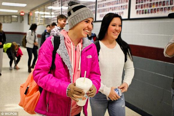 Cô gái 16 tuổi hồi phục nhanh kỳ diệu sau vụ cháy kinh hoàng