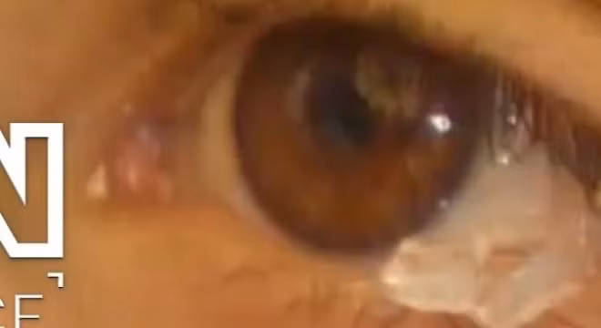 Chuyện lạ: Cô gái khóc ra pha lê