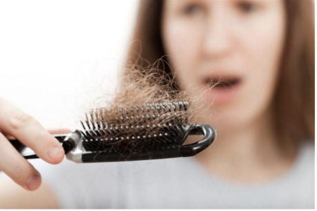 Rụng tóc nhiều là dấu hiệu của bệnh ung thư? - Ảnh 1 Rung toc nhieu la dau hieu cua benh ung thu? - Anh 1