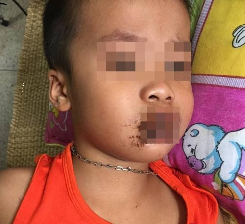 Trẻ uống nhầm hóa chất, thuốc chuột: Người lớn hãy tự trách mình ảnh 1 Trẻ uống nhầm hóa chất, thuốc chuột: Người lớn hãy tự trách mình - 2