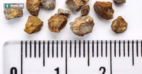 10 doi tuong de bi soi than - Anh 2