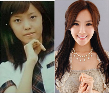 6 idol nữ Kpop ghi điểm nhờ thẳng thắn thừa nhận dao kéo - Ảnh 4 6 idol nu Kpop ghi diem nho thang than thua nhan dao keo - Anh 4