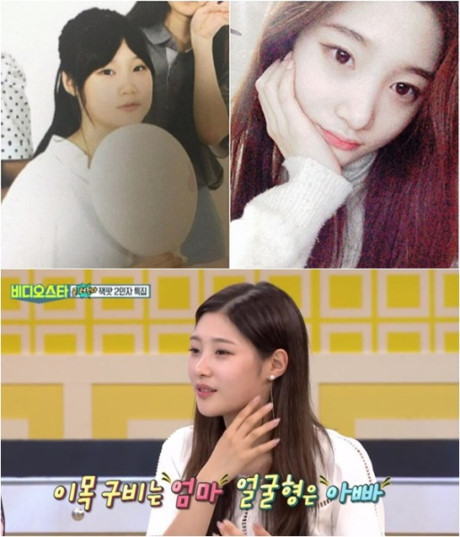 6 idol nữ Kpop ghi điểm nhờ thẳng thắn thừa nhận dao kéo - Ảnh 5 6 idol nu Kpop ghi diem nho thang than thua nhan dao keo - Anh 5