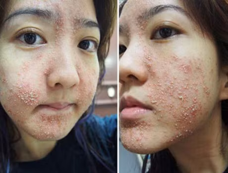 Lan da bi pha huy vi thoi quen dung dau dua sai cach cua hang nghin chi em - Anh 2