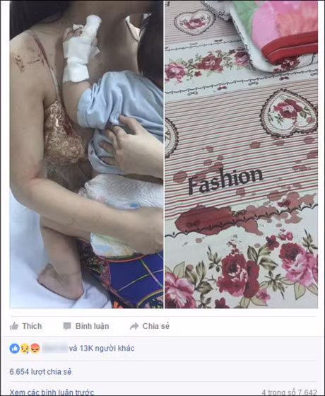 Vi sao tre so sinh co the chet tham vi bi... chuot can? - Anh 1