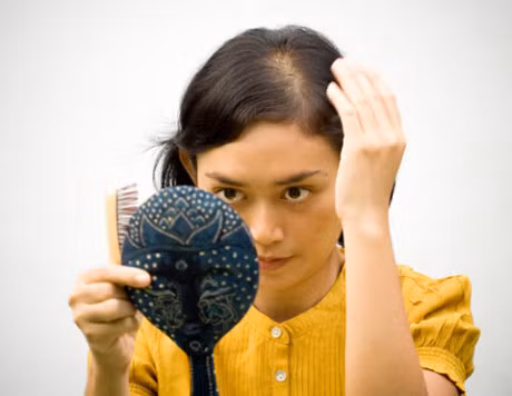 Canh bao benh nguy hiem tu chung rung toc qua nhieu - Anh 1