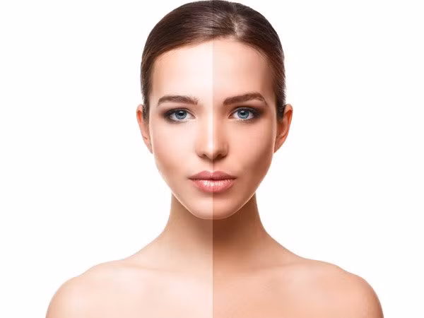 Những cách chữa da cháy nắng hiệu quả 