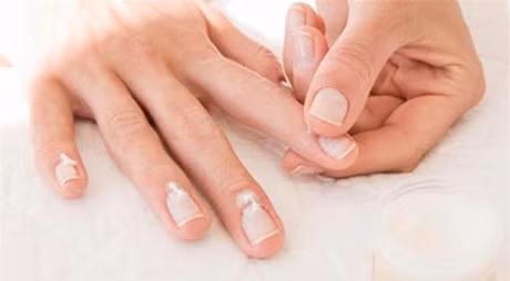 Nhung thoi quen, khien mong tay ngay cang kho, gay khong ly do - Anh 5