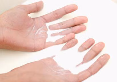 4 cach lam diu tay bong rat hieu qua vi thai ot - Anh 2