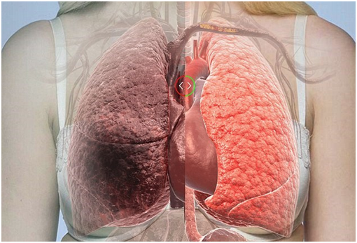 phòng ngừa ung thư