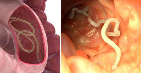 6 loại thảo mộc có khả năng tiêu diệt sạch ký sinh trùng sinh sôi nảy nở trong cơ thể - Ảnh 2 6 loai thao moc co kha nang tieu diet sach ky sinh trung sinh soi nay no trong co the - Anh 2