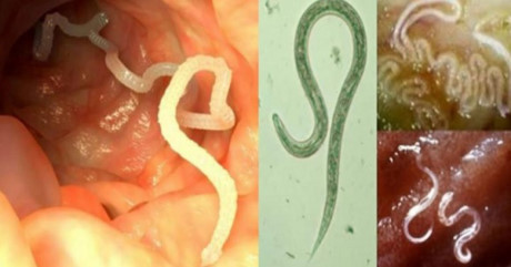 6 loại thảo mộc có khả năng tiêu diệt sạch ký sinh trùng sinh sôi nảy nở trong cơ thể - Ảnh 1 6 loai thao moc co kha nang tieu diet sach ky sinh trung sinh soi nay no trong co the - Anh 1