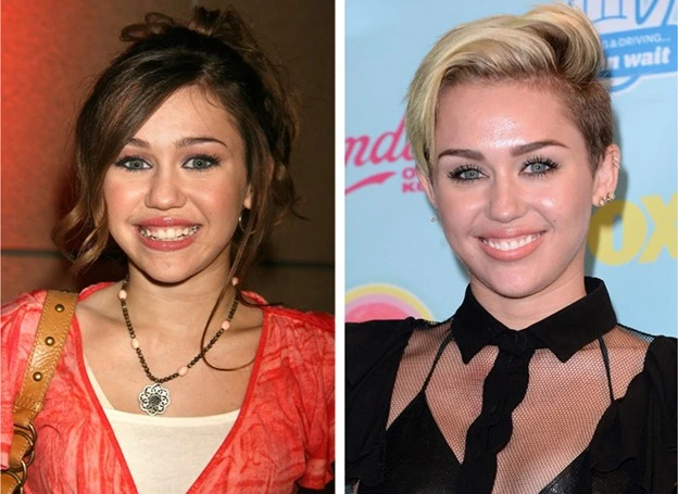 Miley Cyrus từng bị đồn đã sửa mũi. Nếu so sánh kỹ thì có thể thấy cánh mũi của cô có phần gọn gàng hơn.