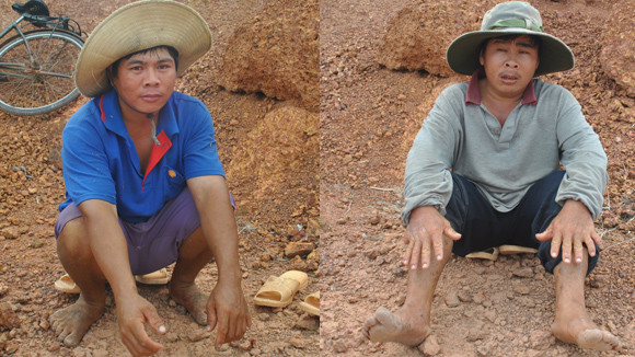 Hai anh em Đặng Văn Vương và Đặng Văn Long có tất cả 48 ngón tay, chân