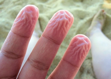 9 cách tự vệ kì lạ của cơ thể mà chẳng ai nhận ra - Ảnh 6 9 cach tu ve ki la cua co the ma chang ai nhan ra - Anh 6