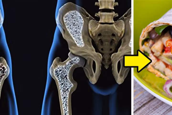 Chọn đúng loại thực phẩm để bộ xương cứng chắc suốt đời