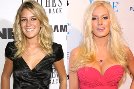 15 my nhan Hollywood kho so vi phau thuat tham my hong - Anh 10