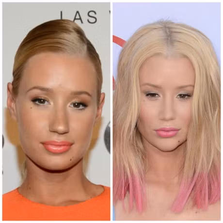 15 my nhan Hollywood kho so vi phau thuat tham my hong - Anh 2