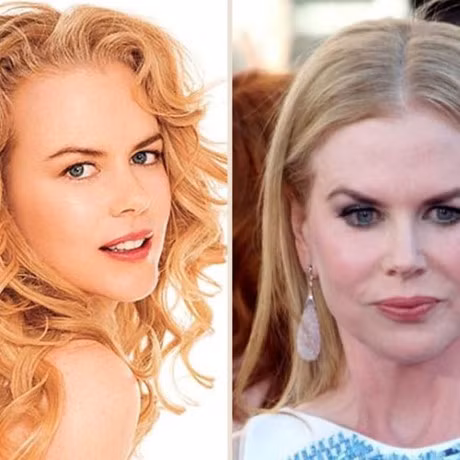 15 my nhan Hollywood kho so vi phau thuat tham my hong - Anh 5