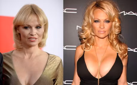 15 my nhan Hollywood kho so vi phau thuat tham my hong - Anh 11