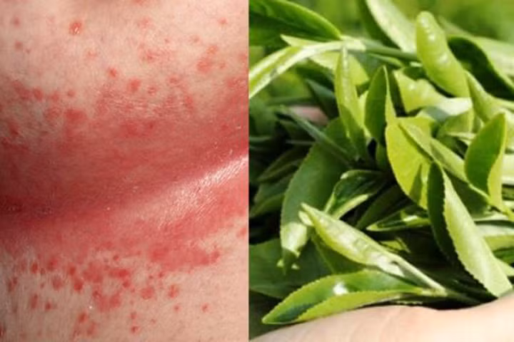 Dùng lá chè xanh theo các này, bé khỏi hẳn hăm tã sau 2 ngày thực hiện