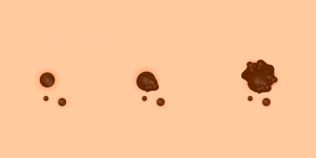 Nốt ruồi lạ. Nếu bé có một nốt ruồi không đối xứng, màu sắc bất thường và lớn (hơn 6mm) xuất hiện trên cơ thể hoặc nốt ruồi có sẵn bắt đầu lớn lên, bố mẹ cần đưa bé đi gặp bác sĩ.