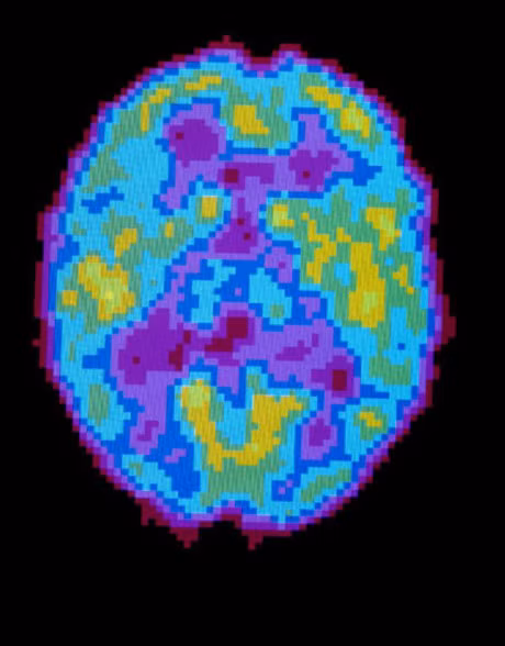 Bat ngo voi nghien cuu moi: ngu la de quen - Anh 2
