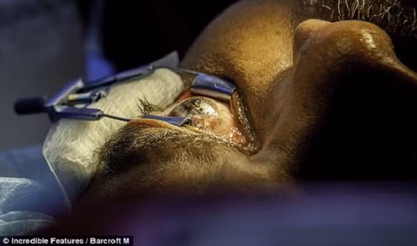 TẾTNhững người xăm mình vì lý do kỳ quái nhất thế giới