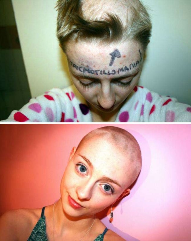 Những chứng bệnh hiếm gặp nhất trên thế giới ảnh 11