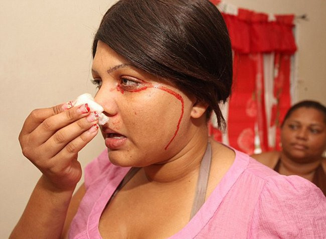 Những chứng bệnh hiếm gặp nhất trên thế giới ảnh 9