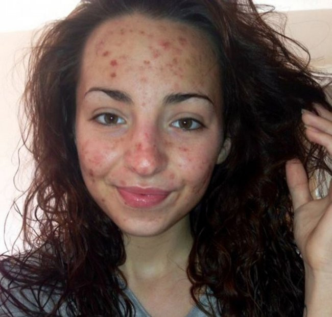 Những chứng bệnh hiếm gặp nhất trên thế giới ảnh 13