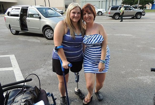 Những chứng bệnh hiếm gặp nhất trên thế giới ảnh 4