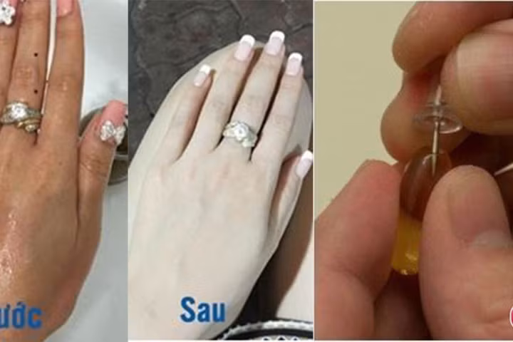 Da trắng bóc lỗ chân lông biến mất 99% khi dùng viên Vitamin E đúng cách