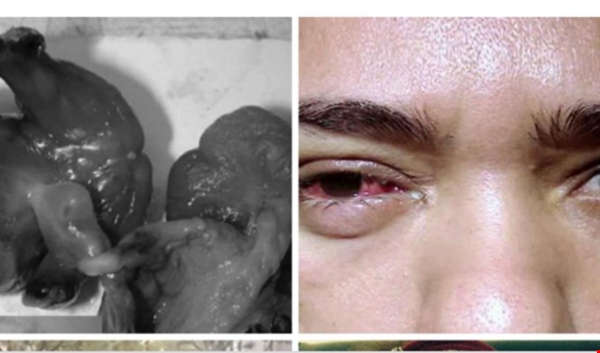 Những sự kiện y học kỳ lạ năm 2015