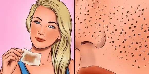 8 sai lầm khi chăm sóc da khiến lỗ chân lông ngày càng to ảnh 8