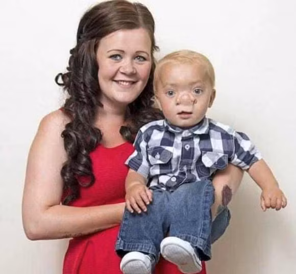 chuyện lạ, cậu bé pinocchio đời thật, dị dạng