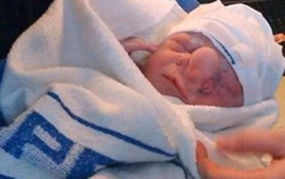 chuyện lạ, cậu bé pinocchio đời thật, dị dạng