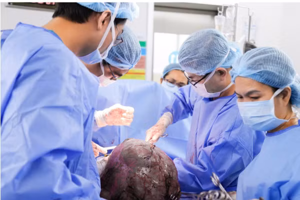 Ê kíp bác sĩ phẫu thuật xử lý khối u xơ nặng 12 ký. 