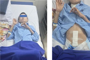 Bác sĩ thăm khám, kiểm tra lại sức khỏe cho nữ bệnh nhân trước ngày ra viện.