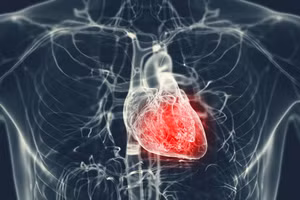 U nhầy thất trái cực kỳ hiếm gặp, chỉ chiếm khoảng 1-2% các trường hợp u nhầy tim được ghi nhận trên thế giới. Ảnh: ITN