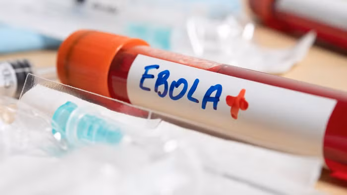 Theo Bộ Y tế, bệnh do virus Ebola là bệnh truyền nhiễm cấp tính nguy hiểm, có khả năng bùng phát thành dịch lớn với tỉ lệ tử vong trung bình khoảng 50%. Ảnh minh họa. 