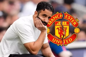 HLV Amorim không quá thất vọng sau thất bại trước Man City.