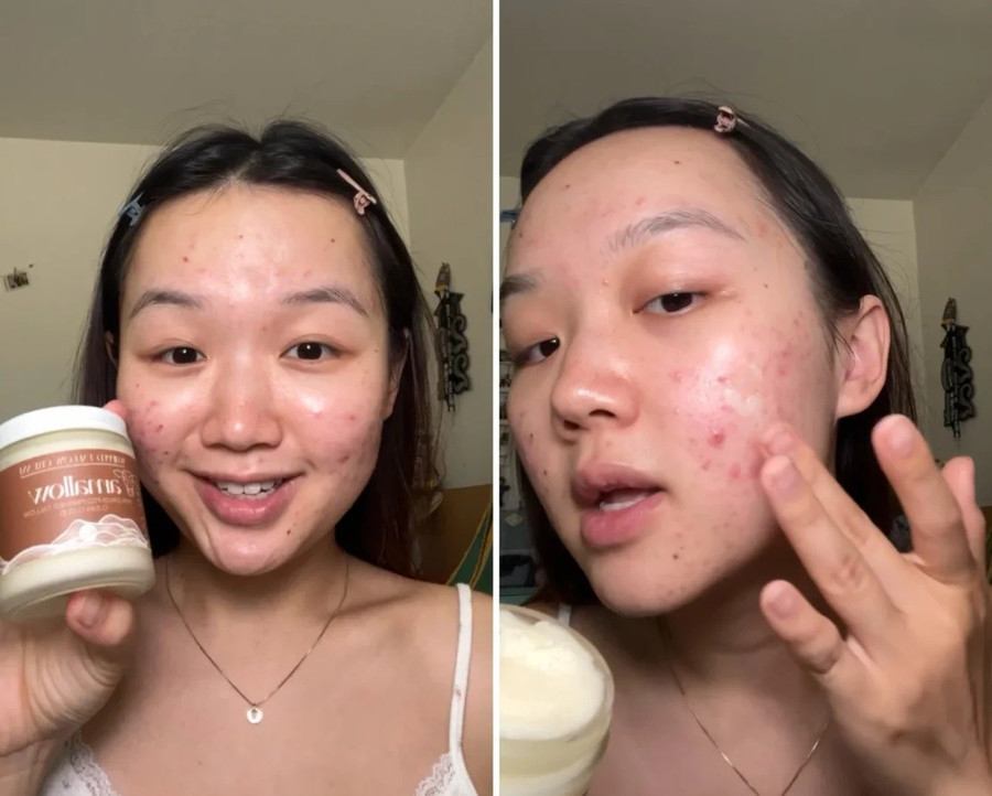 Daniela Martinez bắt đầu kết hợp hạt lanh vào quy trình chăm sóc da của mình sau khi xem video từ những phụ nữ trẻ khác ca ngợi lợi ích của hạt lanh. Ảnh: Daniela Martinez/CNN.