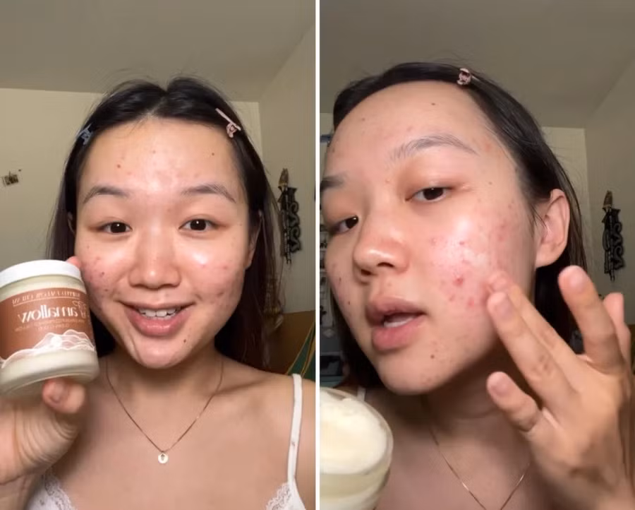 Daniela Martinez bắt đầu kết hợp hạt lanh vào quy trình chăm sóc da của mình sau khi xem video từ những phụ nữ trẻ khác ca ngợi lợi ích của hạt lanh. Ảnh: Daniela Martinez/CNN.