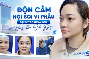 Độn cằm nội soi vi phẫu tại Bệnh viện thẩm mỹ Gangwhoo: Nâng tầm sắc đẹp và an toàn