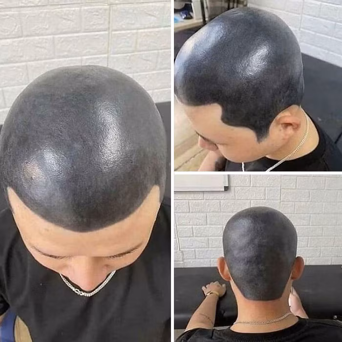 Những sự cố hy hữu khi làm tóc khiến nhiều người mất niềm tin vào thợ tóc