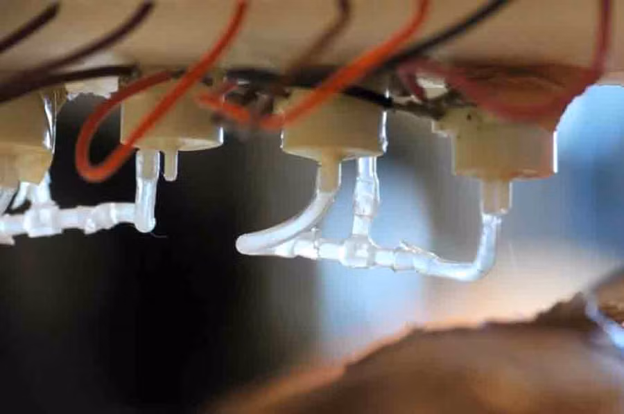 Máy in da người 3D