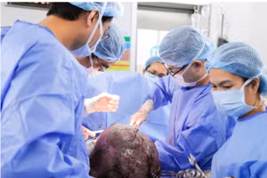 Ê kíp bác sĩ phẫu thuật xử lý khối u xơ nặng 12 ký. 